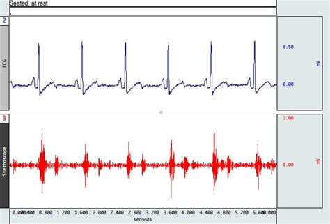 ECG: Cardiology | Heart Sounds | Research | BIOPAC