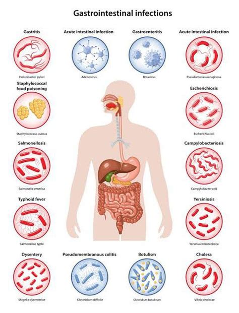 Gastroenteritis symptoms - MEDizzy