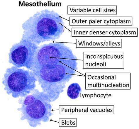 Mesothelium - Wikiwand