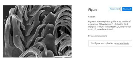 Phylum: Mollusca & their radula | Cephalopod Radula under the SEM