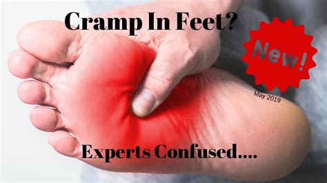 What Causes Cramp In Feet? | Experts Confused About Leg and Foot Cramps ...