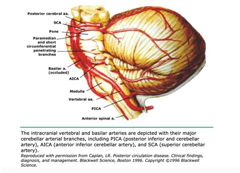 Posterior Circulation Stroke – Core EM