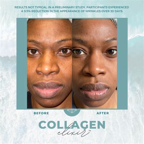 Collagen Transformation 40 - Healthy Body Team