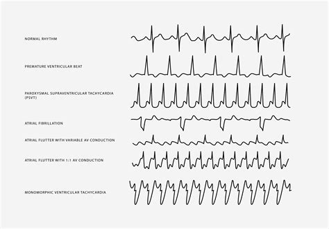 Heart Rhythm Set Vector 182818 Vector Art at Vecteezy