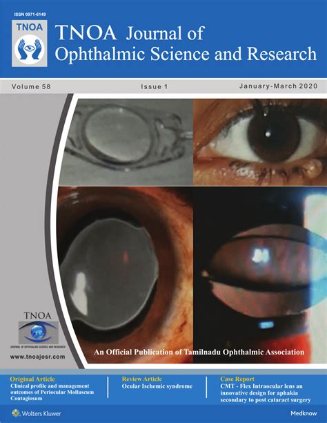 (PDF) OCULAR ISCHEMIC SYNDROME TNOAJOphthalmicSciRes 2020 58 1 20 279999