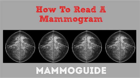 How to Read a Mammogram: Comprehensive Step-by-Step Guide