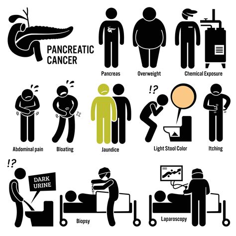 Pancreatic Cancer Symptoms and Treatment | CyberKnife Miami