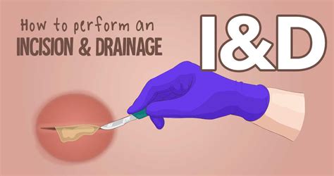 I&D: How to perform an Incision & Drainage | Health And Willness