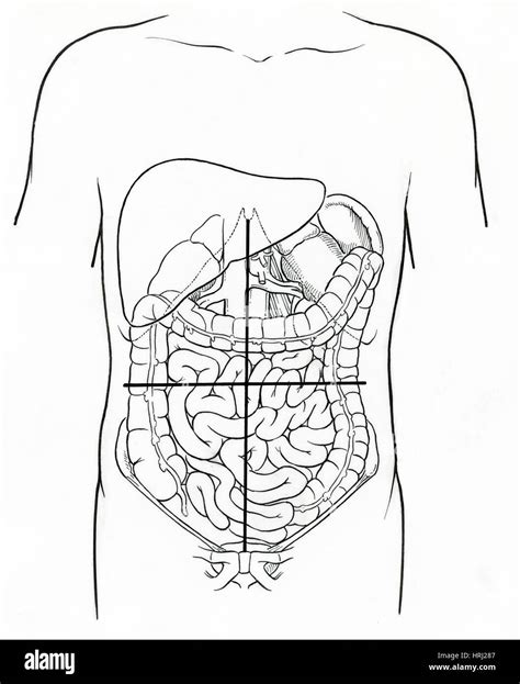 Abdominal Cavity Quadrants