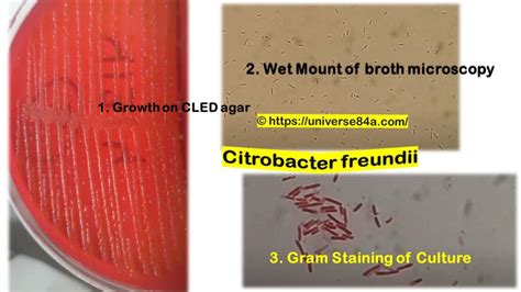 Citrobacter freundii: Introduction, Morphology, Pathogenicity, Lab ...