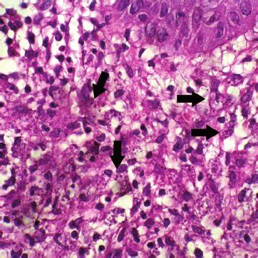 (PDF) Clinical, Histopathologic, and Cytologic Diagnosis of Mucosal ...