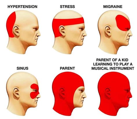 Different Headache Types Chart