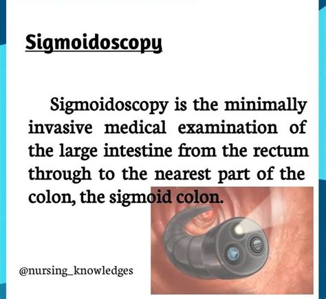 Sigmoidoscopy - MEDizzy