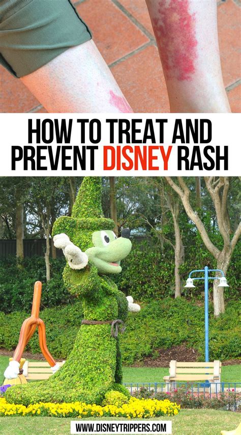 How To Treat And Prevent Disney Rash Disney Travel, Usa Travel, America ...