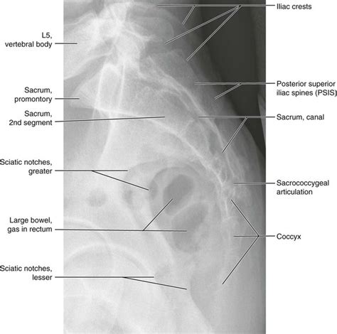 Normal Anatomy | Radiology Key