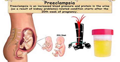 👉 Bubbles in urine - What does bubbly urine mean ? (female, pregnancy ...