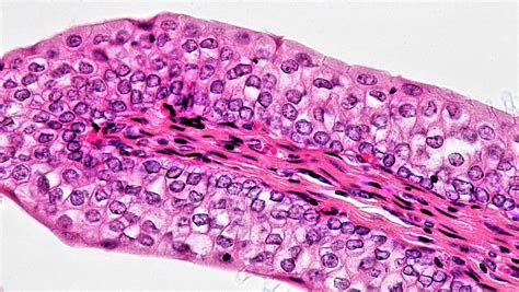 Mammalian Histology: Epithelial Tissues – Berkshire Community College ...