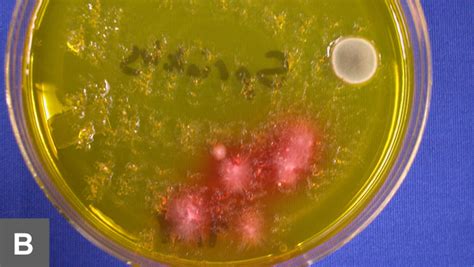 Microscopic Examination of Fungal Cultures | Clinician's Brief