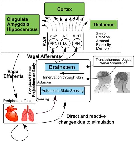 Vagus Nerve Stimulation Side Effects