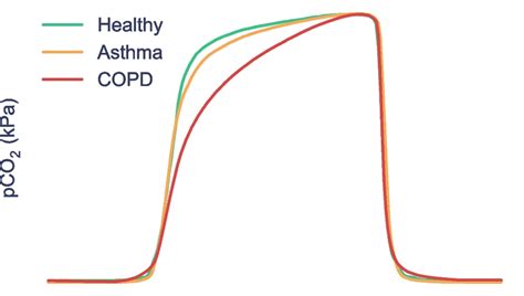 Average capnogram waveforms across all healthy, COPD and asthmatic ...