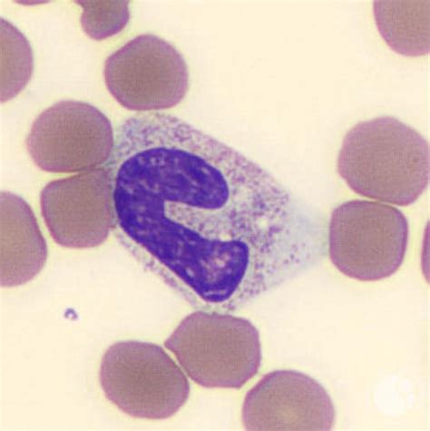 Band neutrophil