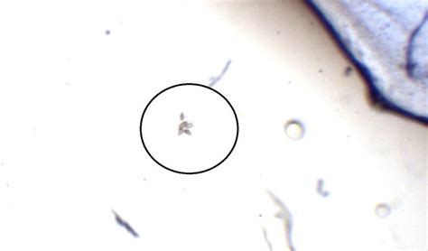 Clonorchis sinensis – Egg – Parasitology