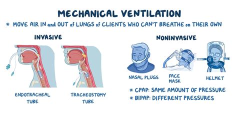 Encommium Incorporare membro invasive ventilation types Danubio calmati ...