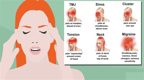 Nausea Dizziness Headache