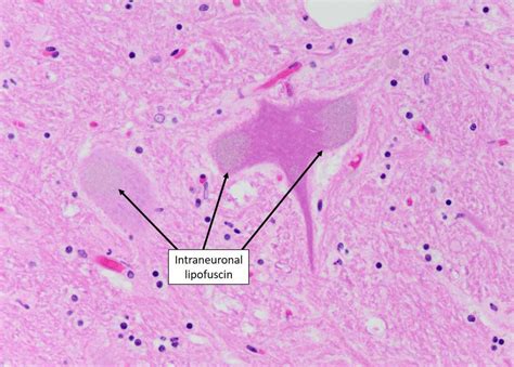 Cell Inclusions – Veterinary Histology