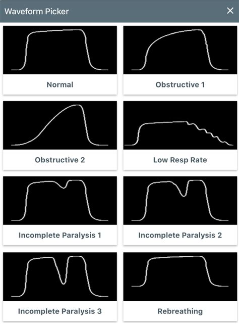 Control - Section 2: ETCO2 and Respiratory Rate Control – iSimulate