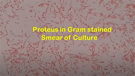 Proteus mirabilis in Gram Stained smear of culture - YouTube