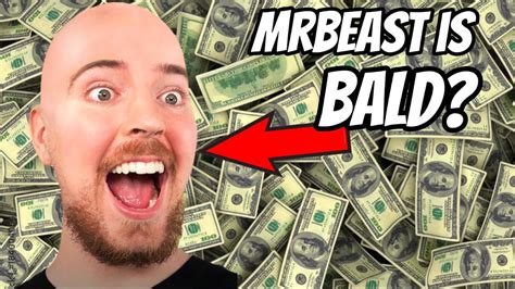 Why is MRBEAST BALD? - YouTube