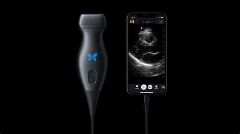 The world’s first portable full body ultrasound introduced by Butterfly ...