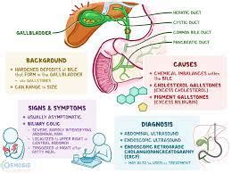 Choledocholithiasis: Symptoms, Diagnosis, and Treatment - Businessegy