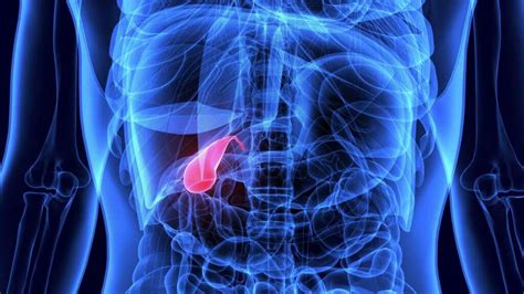 Acute Cholecystitis: What Is Acute Cholecystitis?