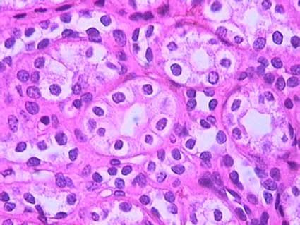 Renal Tubule Histology