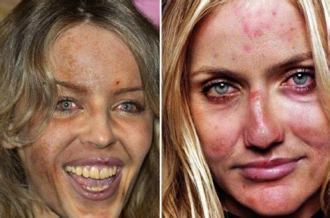 As Amy shows her scabby face, here's other celebrities without the ...