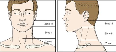 Zones Of The Neck