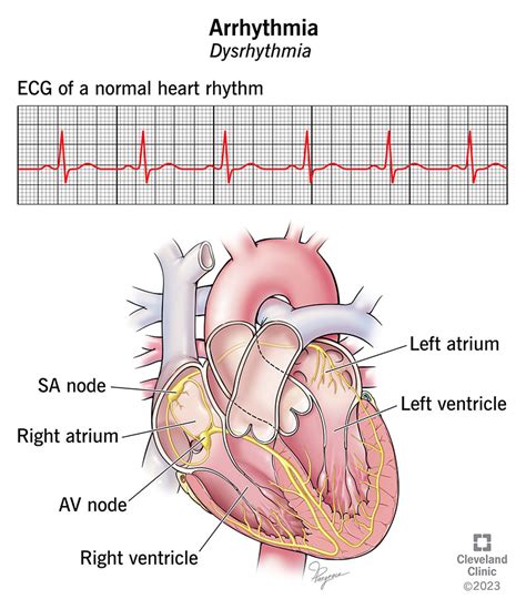 Critical Care Cardiac Heart Beat