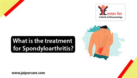 What is the treatment for spondyloarthritis? | Dr. Bhuupendra Vaishnav