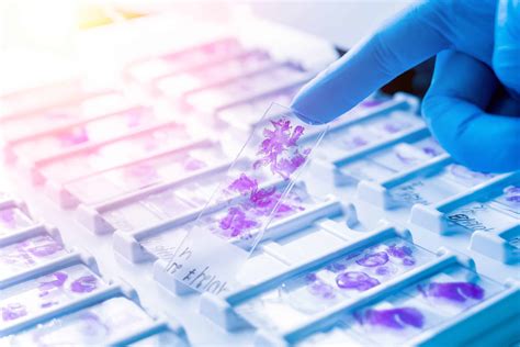 Formalin-Fixed, Paraffin-Embedded (FFPE) Tissue - Logical Biological