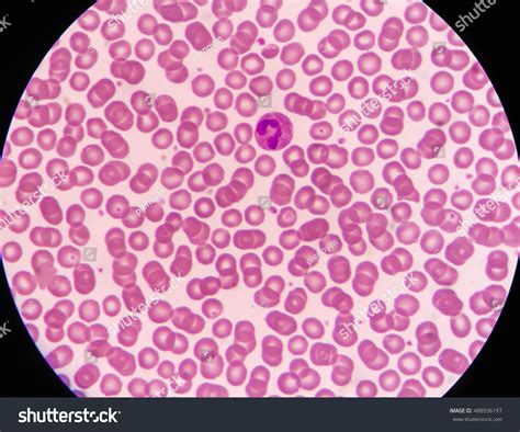 Red Blood Cells Under Microscope Labeled