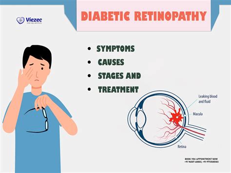 Diabetic Retinopathy – Symptoms, Causes, Stages, and Treatment