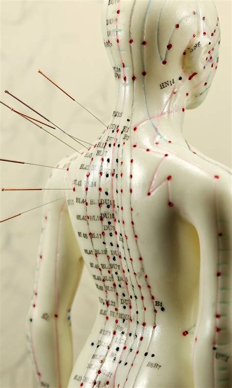 Our Services | Acupuncture Therapy & Treatments Christchurch