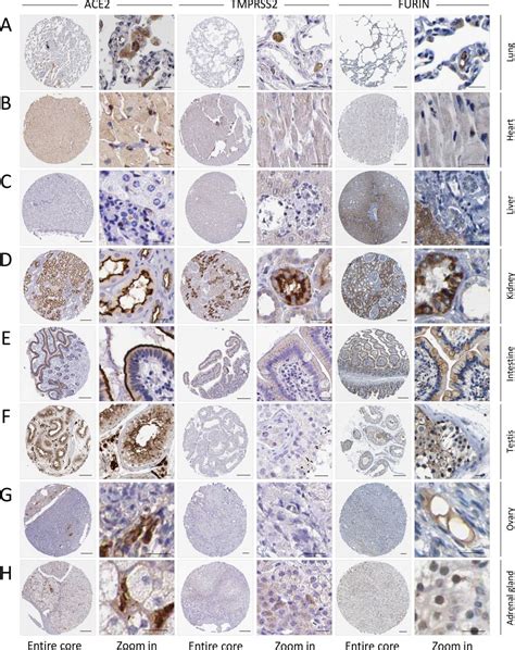 Invasive Ductal Carcinoma Triple Negative Treatment