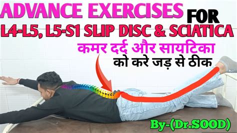 Advanced exercises for FIX L4- L5,L5-S1 slip disc & Relief sciatica ...