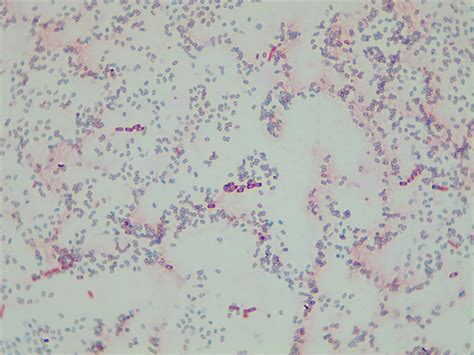 Bacillus Subtilis Gram Stain 1000x