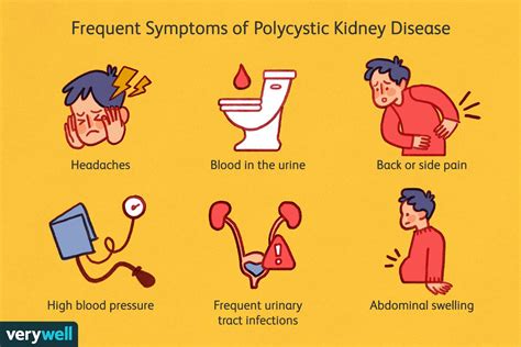 Polycystic Kidney Disease: Signs and Symptoms