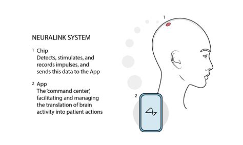 Neuralink Patient Journey | Andrea Yip