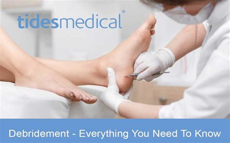 Types of Debridement - Everything You Need To Know - Tides Medical